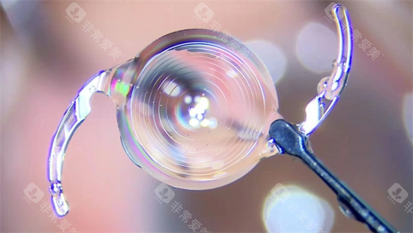 白内障晶体示意图