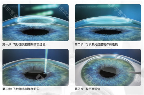 中山大学附属第一医院眼科怎么样，设备可靠科室齐全/治疗常见及危急眼病结果好！