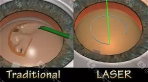 南方医科大学南方医院眼科地址-预约电话号码-简介-技术优势-口碑评价分享！