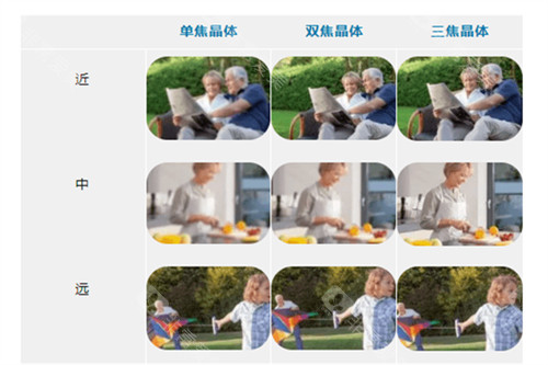 白内障晶体植入单焦点晶体与多焦点晶体区别