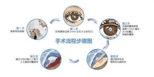 南昌大学附属眼科医院收费贵吗？南昌大学附属眼科医院收费标准公开给你们