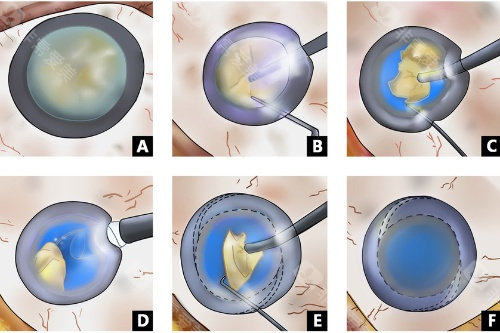 辛集复明眼科医院预约挂号指南!每日8点放未来7天号源+电话/官网/现场挂号攻略！