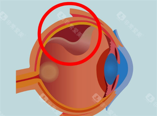 新疆兵团医院眼科杨波医生怎么样?每周几坐诊?周二下午固定坐诊，擅长复杂性眼底疾病及小儿视网膜手术！