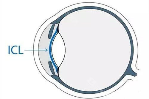 市民好评的哈尔滨近视手术好10大医院排名表出炉!看看哈尔滨麦迪格/爱尔等眼科机构谁更靠谱