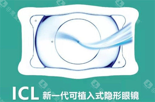 ICL介绍