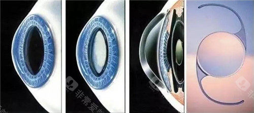 乌鲁木齐第一人民医院眼科怎么挂号，微信公众号/小程序+电话预约，流程便捷快速约！