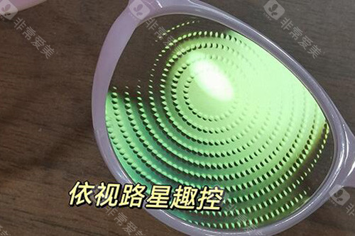 星趣控镜片好不好