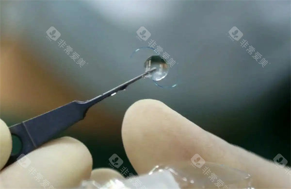晶体植入特写照片