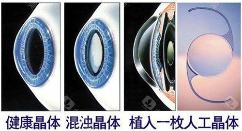 西安市人民医院眼科怎么挂号预约？电话预约/官网预约/现场预约方式流程一览!附放号时间+营业时间! 