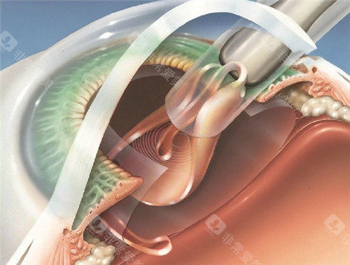 网选上海十大眼科医生排名榜:廉井财、翟爱琴、张晓琳、李霞医生技术好口碑好！