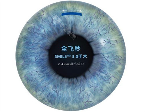 深圳友华普惠眼科是正规的吗？超正规！审批流程合规，操作规范无隐形消费，看眼安心