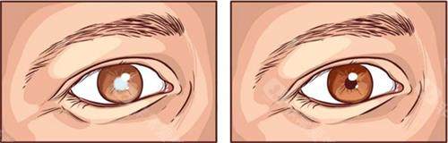 徐州第一人民医院眼科收费价格一览表！收费价格一览表奉上，激光近视、白内障等手术费用有参考了！