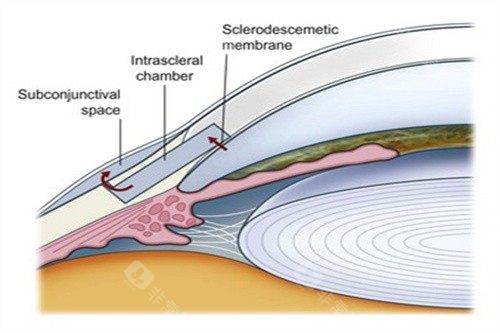 泸州医学院眼科电话是多少？正规客服热线0830-3165200已核实！