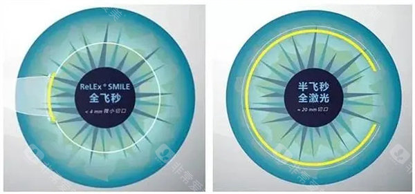 昆明眼科医院口碑评价？超扎实！患者反馈“技术好体验佳”，屈光手术、眼底病治疗双优