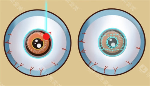 柳州红十字会眼科医院哪个医生好?韦乐强/黄红波/‌翟建伟‌/黄红波/韦玉玲‌/‌姜勇等医生介绍及坐诊时间分享!