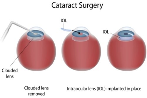 柳州红十字会医院眼科预约挂号+上班时间+放号时间一览！电话/官网/现场预约等线上线下渠道都能挂号！