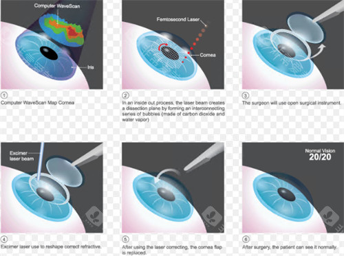 2026年眼科问诊在线问询免费：24小时免费询问通道+在线预约国内眼科医院攻略指南！