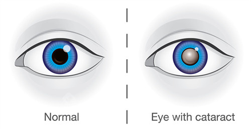 大连3院眼科预约挂号方式+流程：电话预约、官网预约、现场预约等多渠道挂号预约攻略指南！