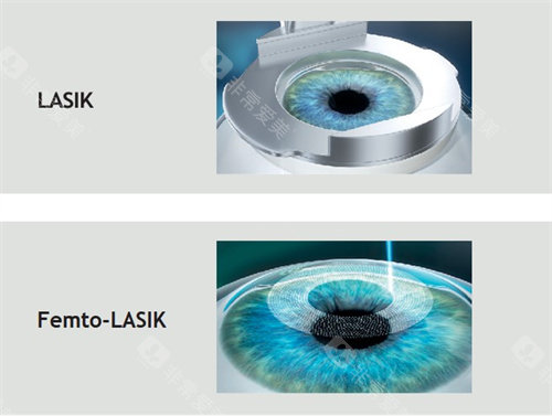 四川华西医院眼科手术费用？透明实惠！全飞秒15000元起，ICL晶体植入25000元起，无隐形消费