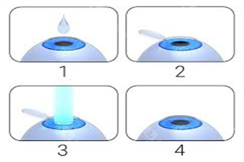 四川华西医院眼科好不好？超优质！医师团队实力出众，术前检查超全，术后随访到位，患者信赖度高