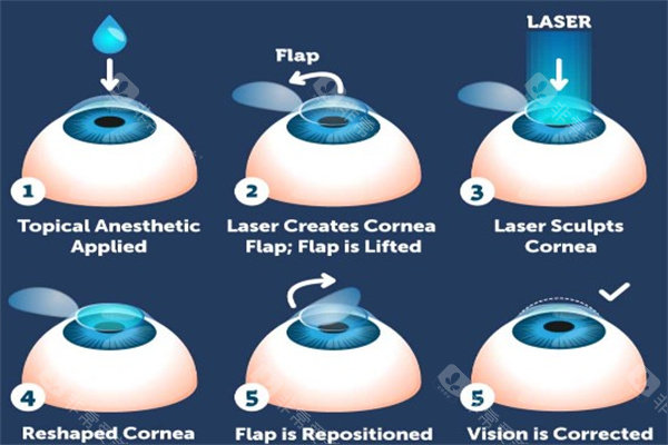 攀枝花五医院眼科哪个医生好？白内障/青光眼/小儿斜视全覆盖，11位医师专长+适配场景一文理清