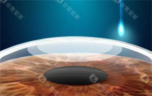 石家庄爱眼眼科医院是我国正规医院吗？爱眼眼科资质正规+收费透明，附简介地址和收费价格表!