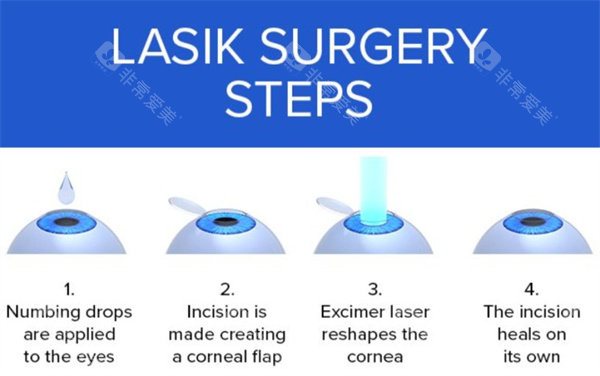 昆明医科第一附属医院眼科怎么样？超出色！综合医院眼科专科，疑难眼病诊疗经验足，近视手术结果有支持