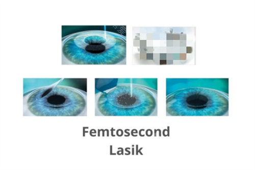 昆明医科第一附属医院眼科预约挂号？超顺畅！正式平台一键约号，支持医师号预约，就诊流程清晰