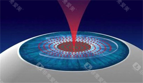 2026华厦眼科医院收费价目表公布！收费价目表已出炉，涵盖全飞秒、ICL等，收费清晰拒绝套路！