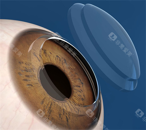 四川华西眼科医院简介资料：源自1894年存仁医院，年手术2万台，角膜移植及屈光手术可预约