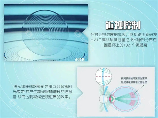 宁夏朝聚开明眼科医院医生介绍：范文瑾|安宁宇|武淑玲医生技术解析