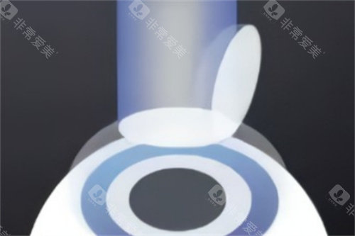 杭州友华普惠眼科好不好？超优质！屈光手术性价比高，术前检查多方面，术后视觉质量佳