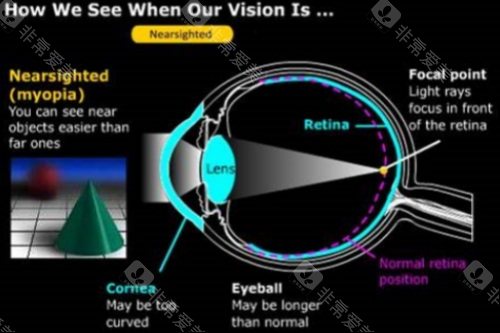 长沙近视手术优选！湖南识目睛点眼科地址/电话/交通路线一键解锁