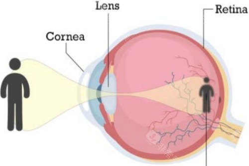 北京同仁眼科医院24小时在线查询++010-5826热线，多渠道预约+路线，问询电话一键直达超省心！