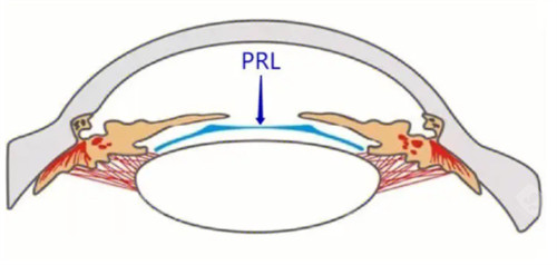四川华西医院眼科晶体植入多少钱？2026全新参考价曝光，不同晶体类型价差+费用构成一文说透