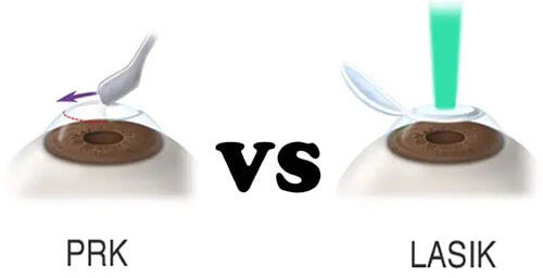 北京同仁医院眼科近视眼手术哪个医生好？周跃华/齐颖/陶冶等擅长术式+反馈，复杂病例适配指南