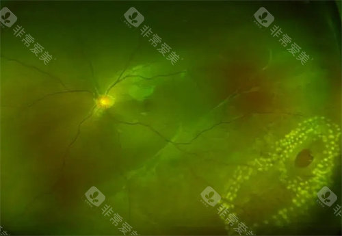 惠州第三人民医院眼科上班时间表！电话号码多少？本篇全汇总，可在线预约！