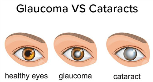 西宁互助巷医院眼科收费价格表：近视眼9800元起、白内障5200元起、青光眼6000元起