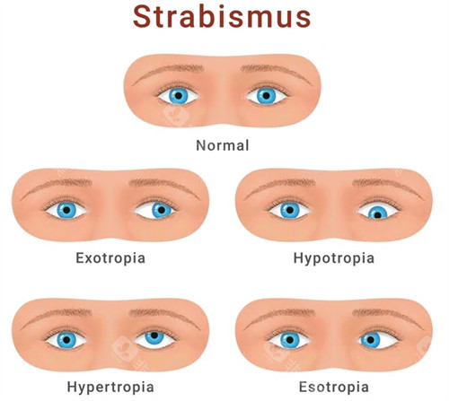 2026年河北省眼科医院收费价格表：全飞秒1.2万元起、ICL晶体植入2.8万元起、白内障手术5000元起