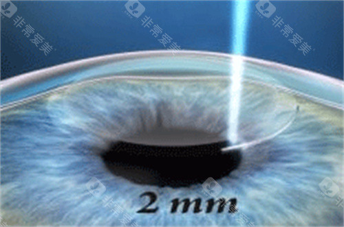 重庆渝北区眼科哪家正规？中新美陆与星辉眼科项目对比及2026价格参考~