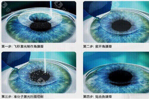 顾客评价重庆渝中区眼科医院排名榜：普瑞眼科医师多，佰视佳性价比高，爱成全科强...