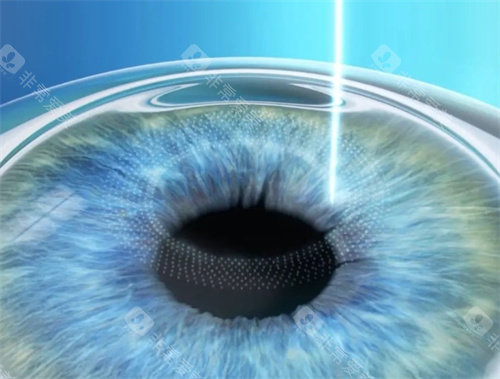 昆明近视手术医院排名：本地人评价昆明华厦眼科靠前吗？正规医院+医生梁刚解析