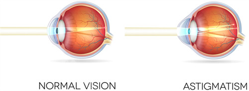 云南省眼科医院好不好？提供多方面眼科服务，口碑佳，患者满意度高