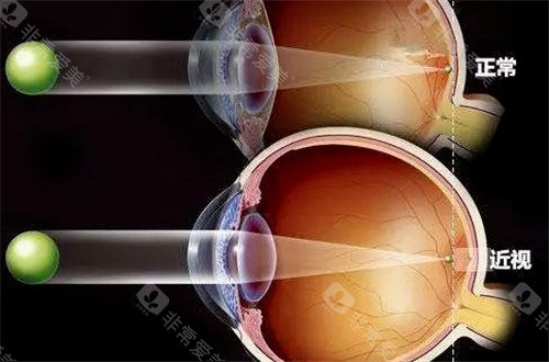 法瑞西单抗是哪国生产的？瑞士罗氏研发+中欧美多版本产地揭秘，双通路眼底药生产标准一文说透