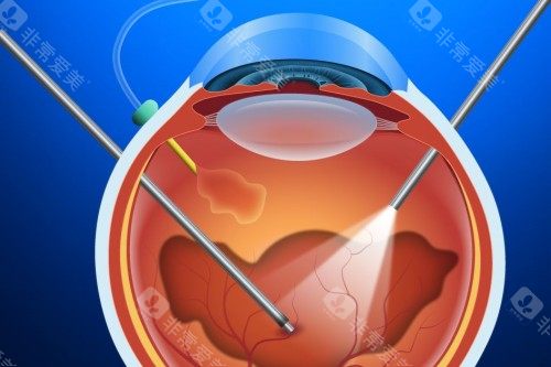 同仁医院黄瑶医生出诊表_北京同仁医院黄瑶出诊日期一看，附黄瑶医生预约挂号方式流程！