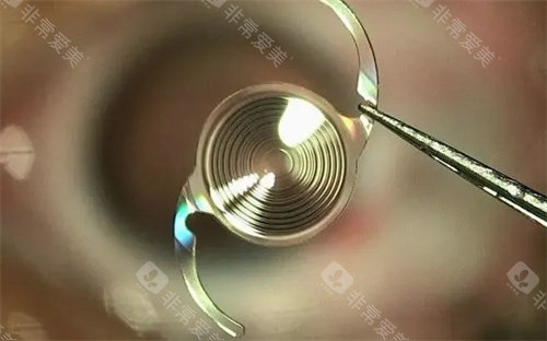 深圳老花眼手术哪家好?黑马眼科、华厦眼科、新安希玛林顺潮眼科治疗老花眼技术好口碑好!