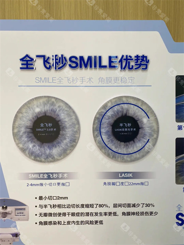 2026更新上海全飞秒SMILE Pro价格在线查询，屈光矫正收费明细，含术前检查术后复查费用参考