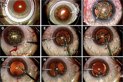 龙岩华厦眼科怎么样好不好，设备新医生技术出色/各类眼病诊疗都靠谱！