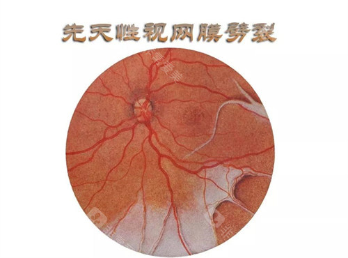 潜江市中心医院眼科预约挂号？线上提前预约挂号，线下挂号机可以挂号！