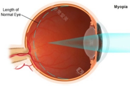 想知道广东雷诺眼科医院电话和地址？这里有广州、惠州多地详细信息，速来了解！